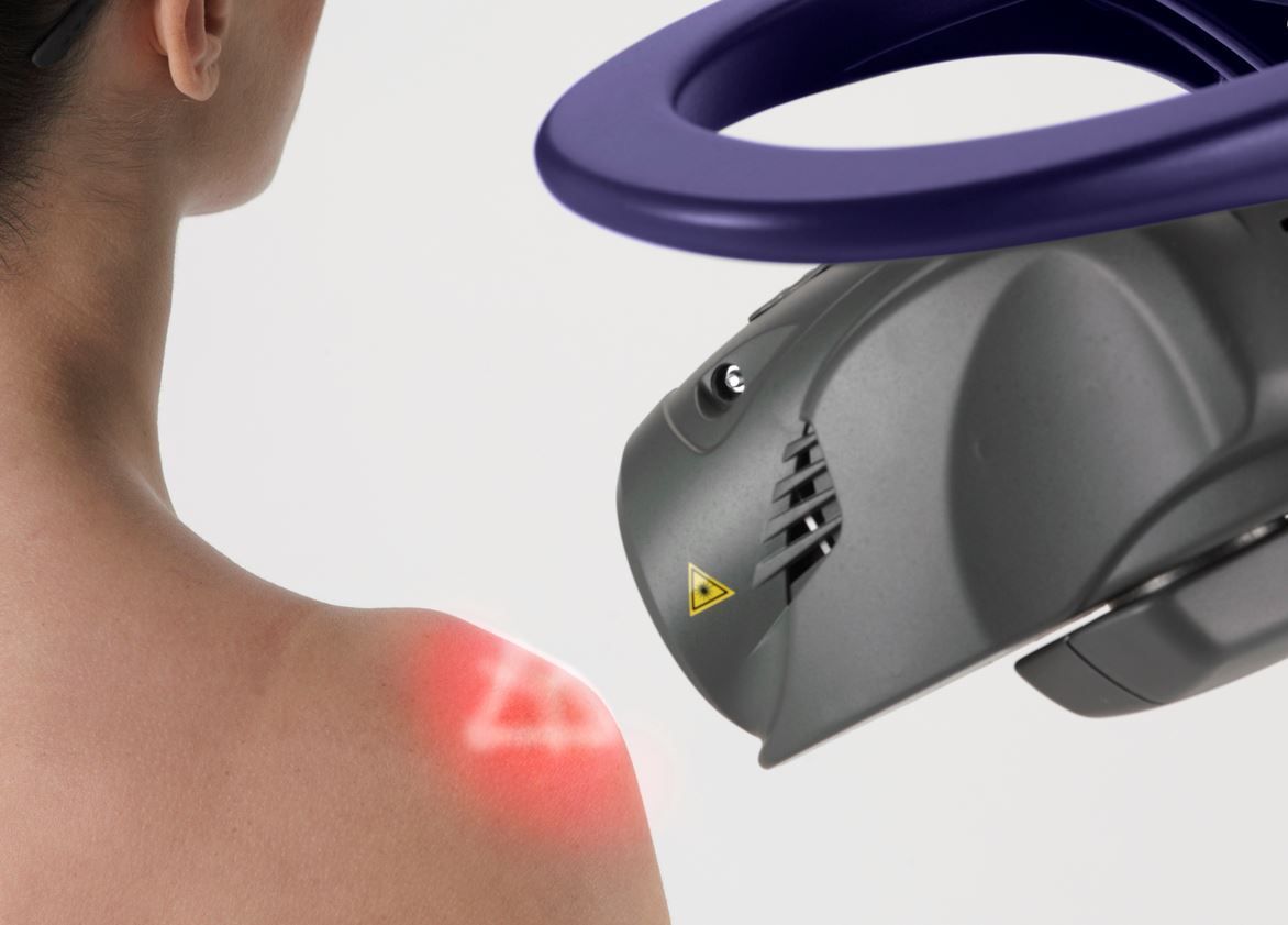 A person's shoulder being treated with a laser device, emitting red light.