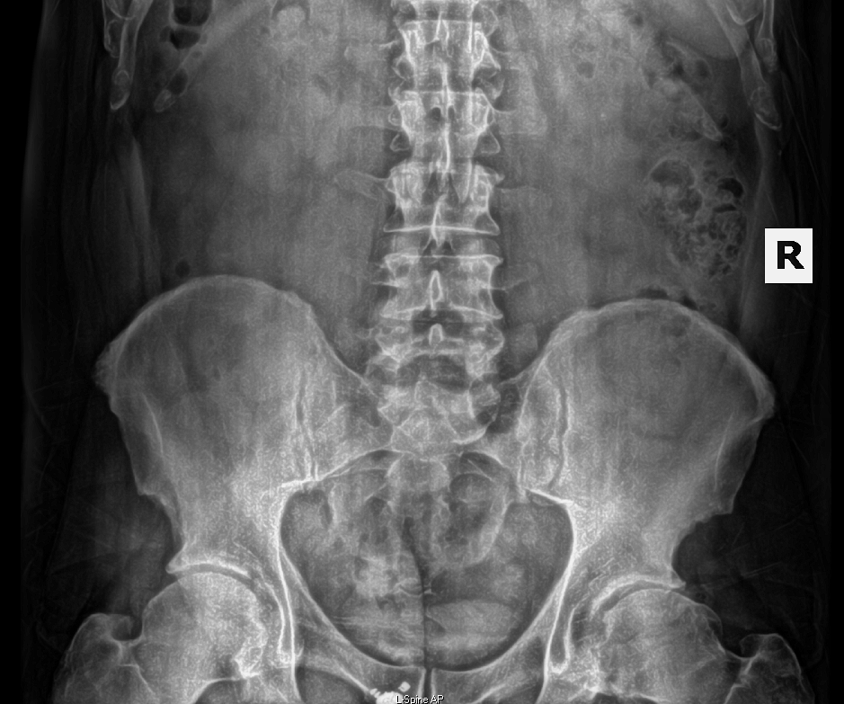 A man is examining a woman 's back in a clinic. WellLife Chiropractic