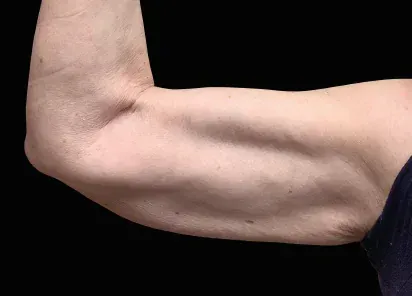A close up of a woman 's arm with a black background.