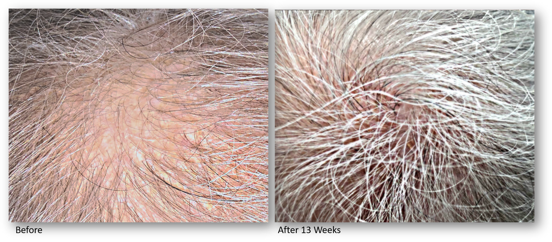 A before and after picture of a person 's hair.