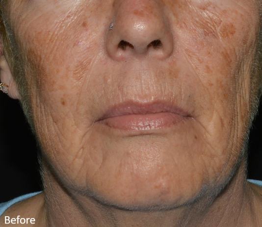 A close up of a woman 's face with the words before below it