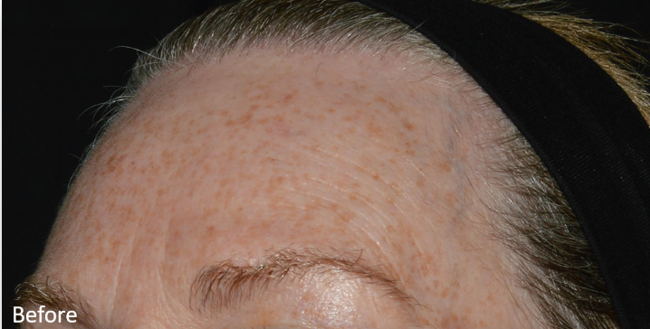 A close up of a woman 's forehead with a black headband.