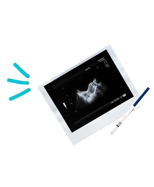 Ultrasound image of a baby developing