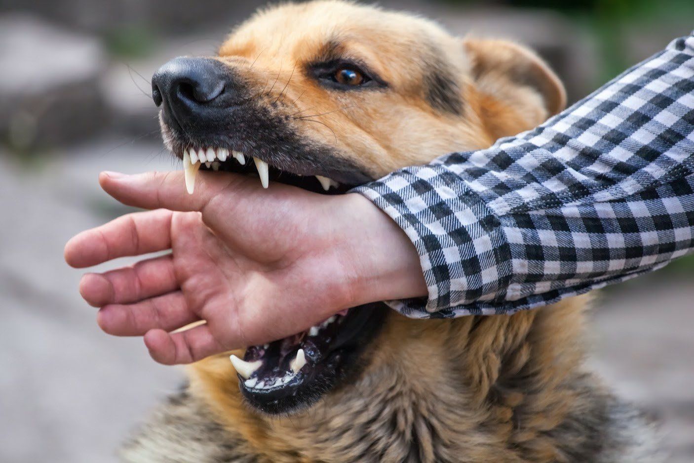 Dog biting a person's arm. The dog has its mouth open, showing teeth. The person wears a plaid shirt.