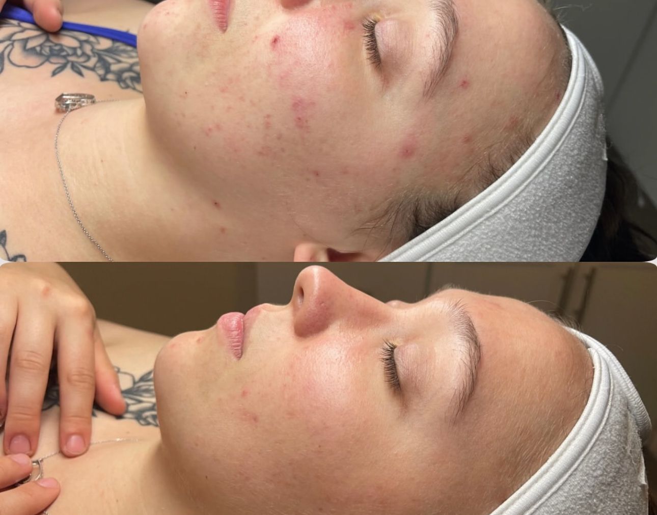 Discover how often you should really get a facial for clear, glowing, healthy skin. Learn the best treatment schedule for acne, anti-aging, and maintenance + book your customized facial at Future You Skin in Gahanna, Ohio.