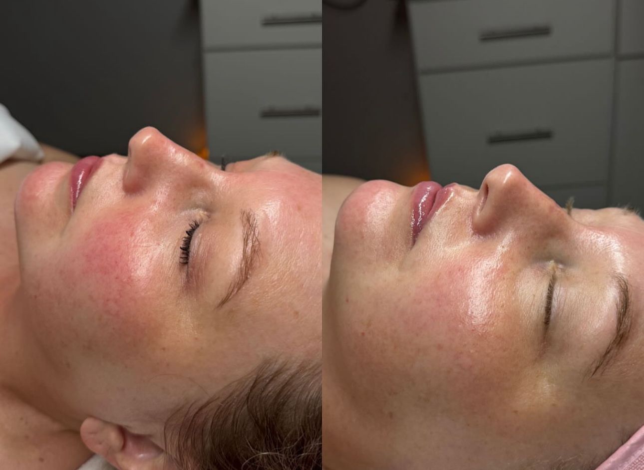 Discover how often you should really get a facial for clear, glowing, healthy skin. Learn the best t