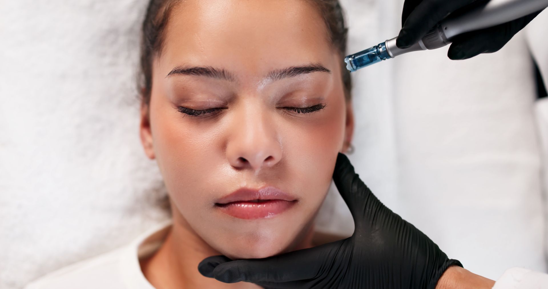 Gloved practitioner injects facial filler near a woman’s eye in a clinical setting