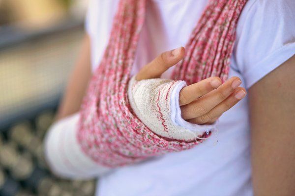 Injured Arm — Chattanooga, TN — Vaughn Spine and Orthopedics P.L.L.C. Injured Arm — Chattanooga, TN — Vaughn Spine and Orthopedics P.L.L.C.