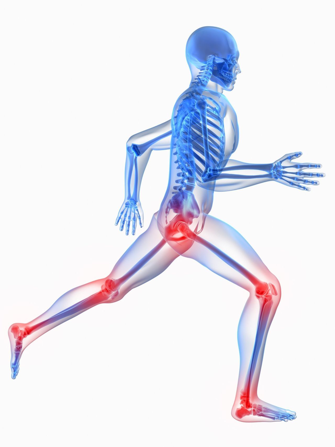 Sports Injuries and Fractures — Chattanooga, TN — Vaughn Spine and Orthopedics P.L.L.C.