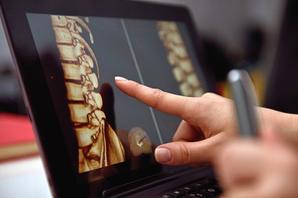 Spine Treatment — Chattanooga, TN — Vaughn Spine and Orthopedics P.L.L.C. Spine Treatment — Chattanooga, TN — Vaughn Spine and Orthopedics P.L.L.C.