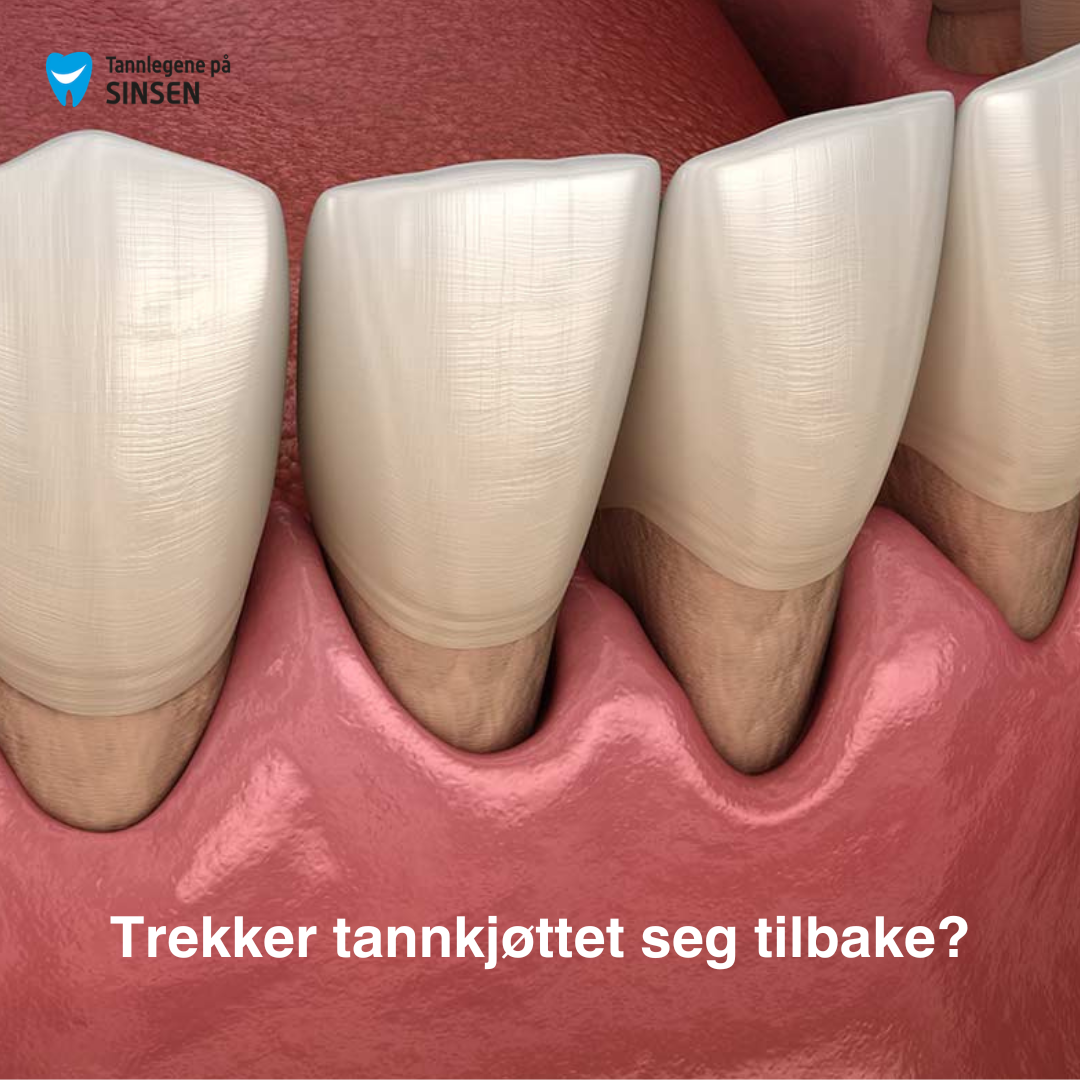 Periodontitt Helfo refusjon