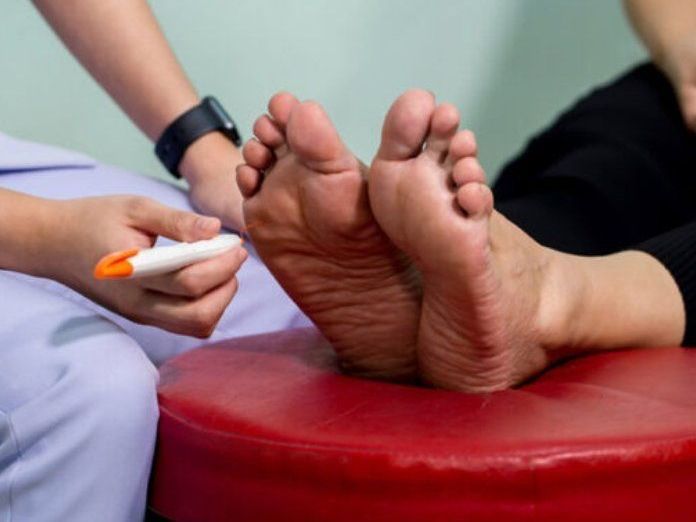 PERIPHERAL NEUROPATHY