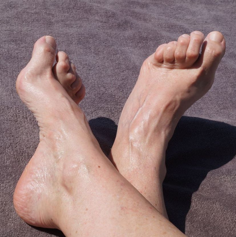 HAMMERTOES