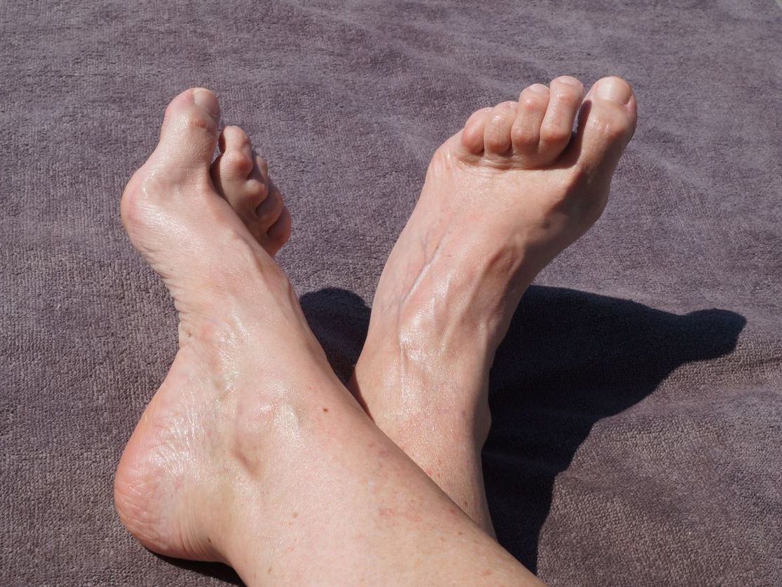 HAMMERTOES