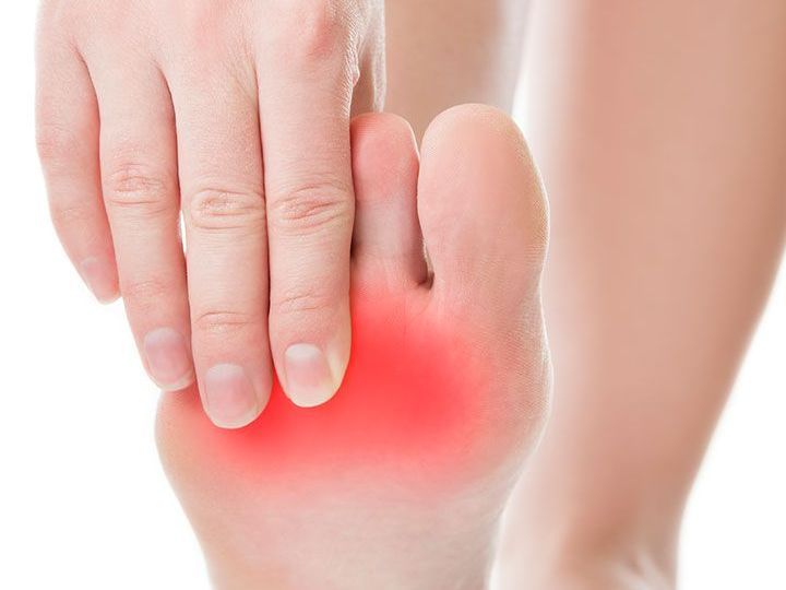 mortons neuroma