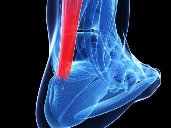 tendonitis