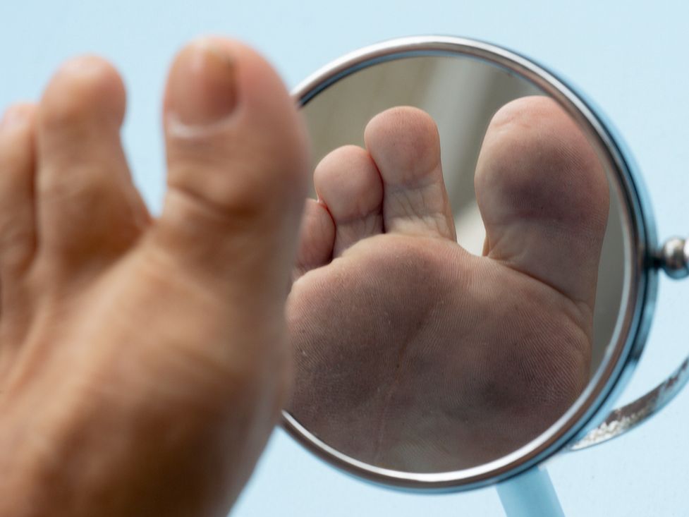 SKIN AND NAIL DISORDERS