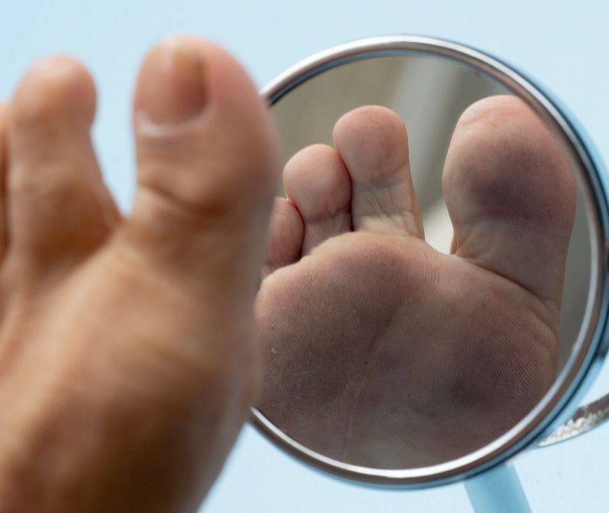 SKIN AND NAIL DISORDERS