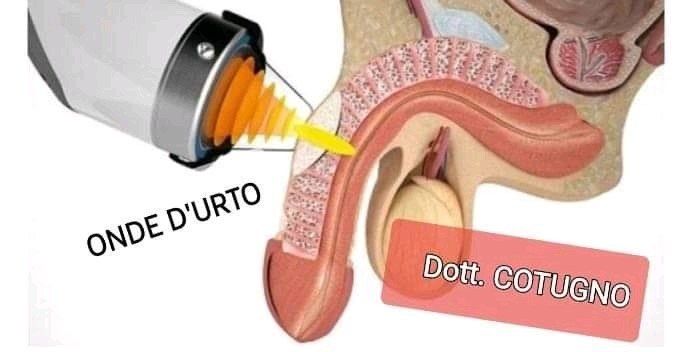 onde d'urto