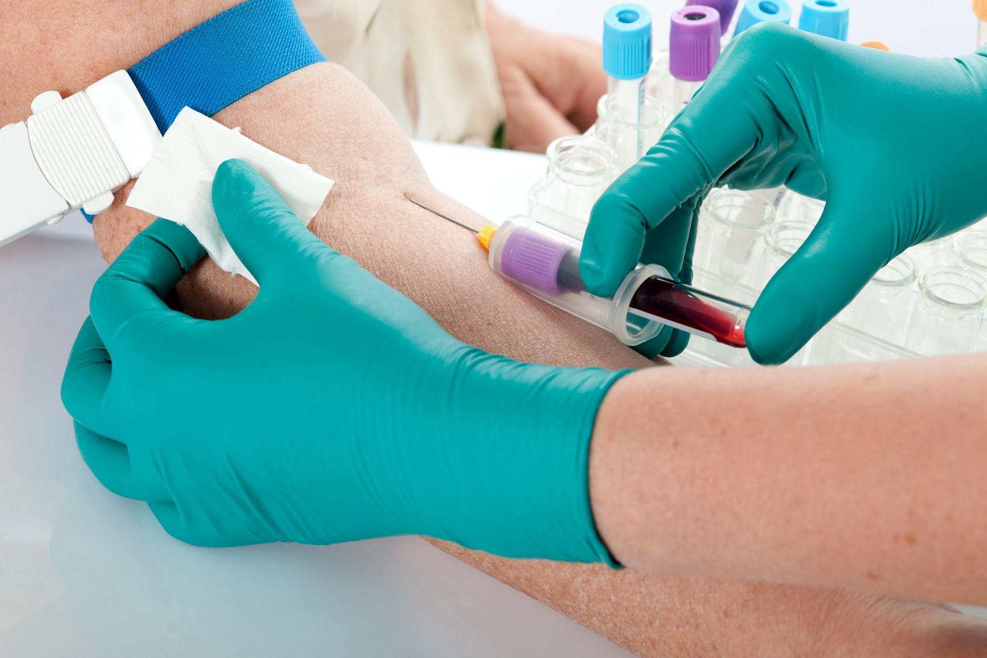 At-Home Blood Draw in Phoenix, AZ At-Home Blood Draw in Phoenix, AZ