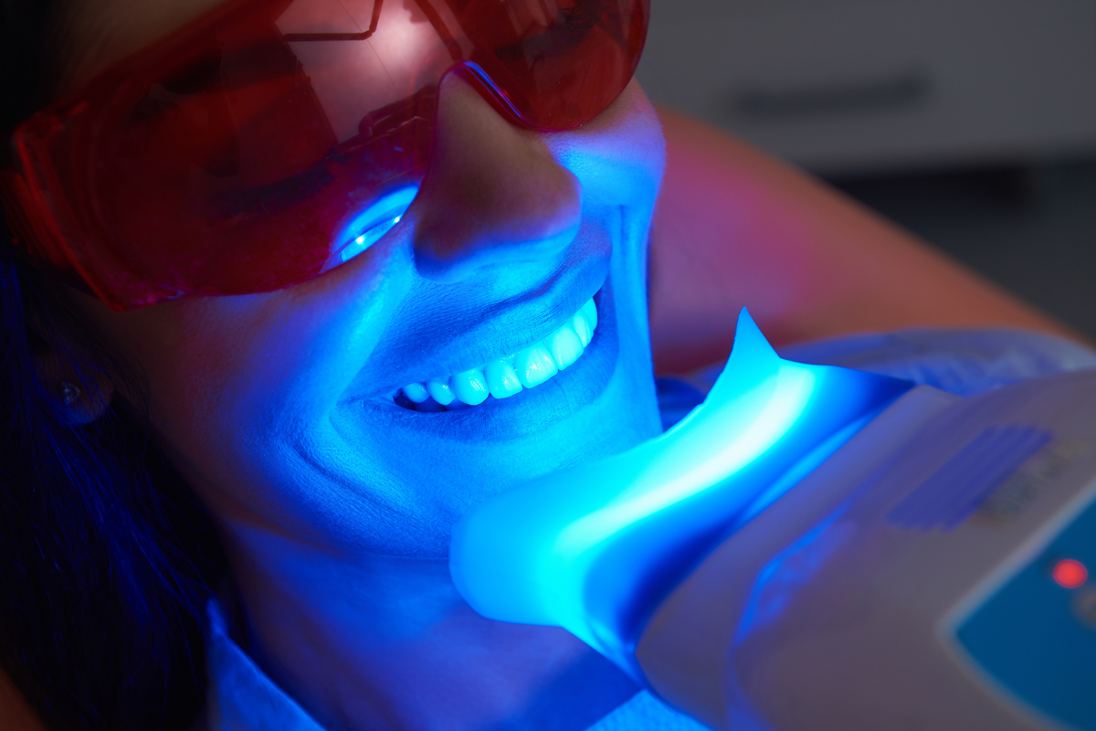 Model of dental implants in a pink gum model with three white teeth attached to silver implants.