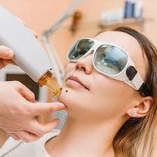 A woman wearing sunglasses is getting a laser treatment on her face.