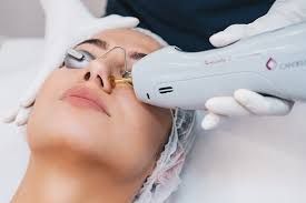 A woman is getting a laser treatment on her face.