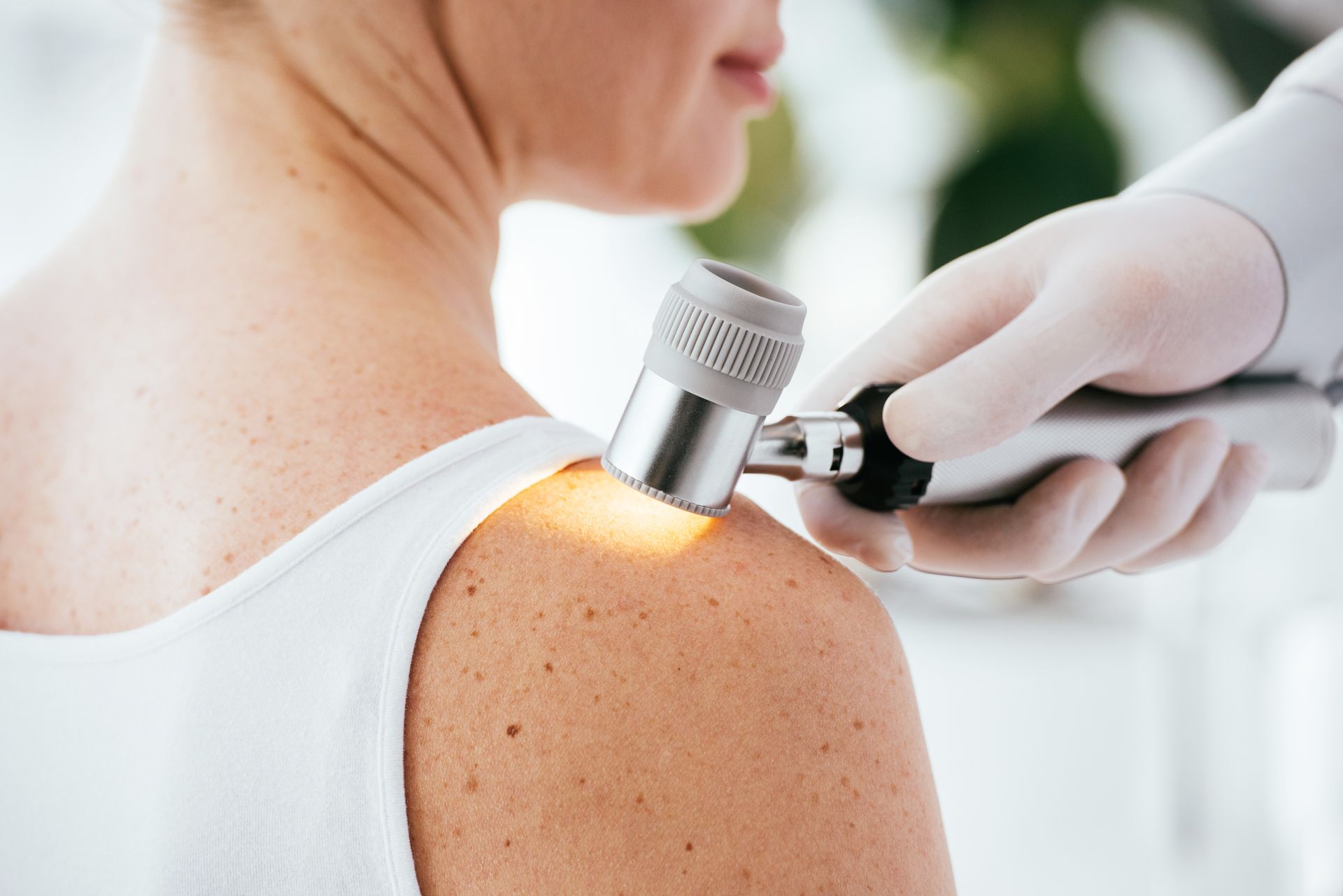 Cropped view of dermatologist holding dermatoscope. Cropped view of dermatologist holding dermatoscope.