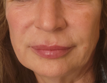 Close-up of a person's face. They have light skin, visible wrinkles, and full lips.