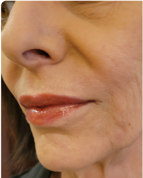 Close-up of a person's lower face, showing nose, lips with glossy lipstick, and wrinkles on the skin.