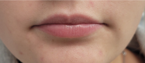 Close-up of a person's lips. The lips are lightly colored and slightly parted.