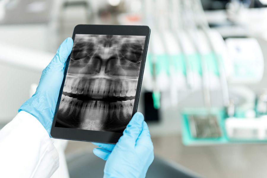 Panoramica dentale