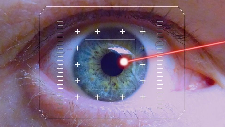 lasik