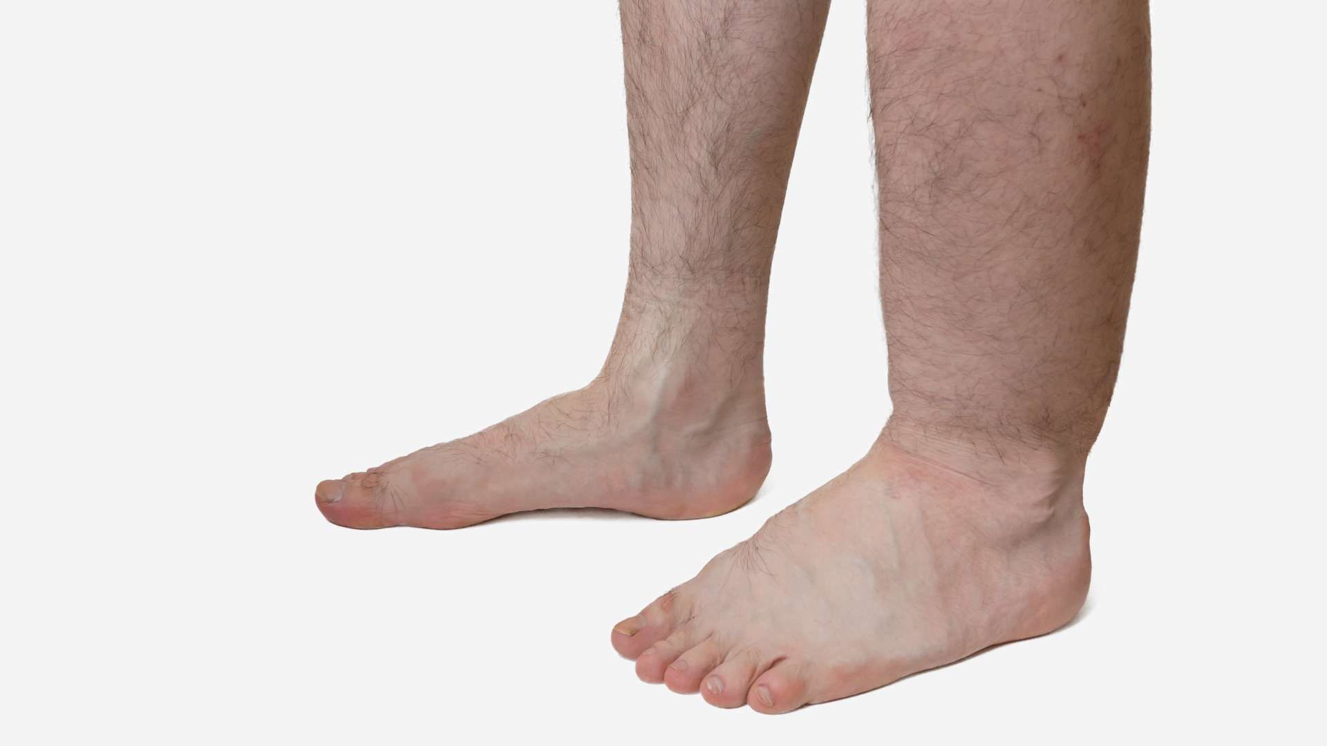 Bare lower legs and feet standing on a white background