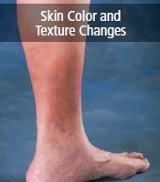 skin color and texture changes