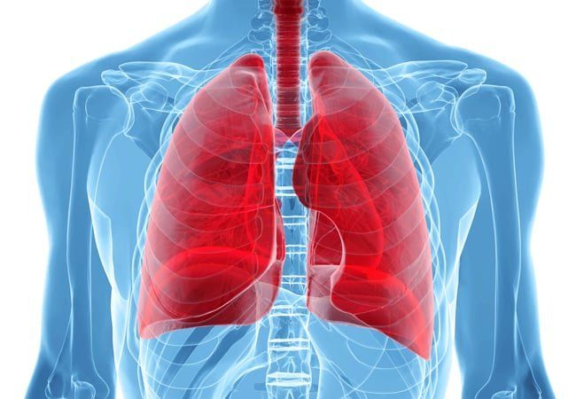 Image of lungs x-ray