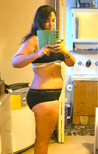 Bariatric Weight Loss Surgery Liverpool, NSW & Kogarah