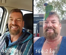 Before & After Weight Loss Surgery Sydney and Liverpool, NSW