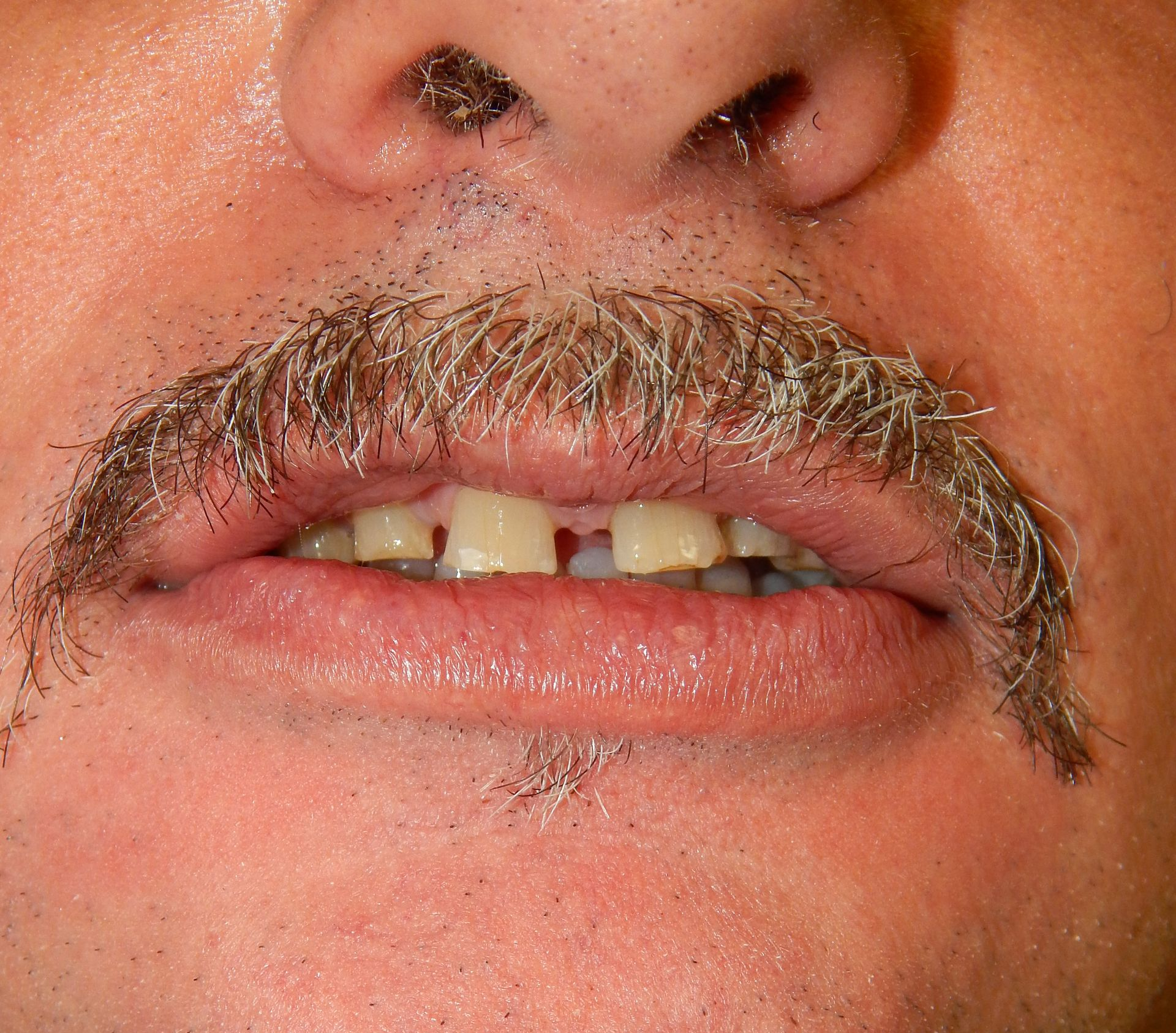 Primo piano di una bocca sorridente con i baffi, i denti visibili e il naso sopra