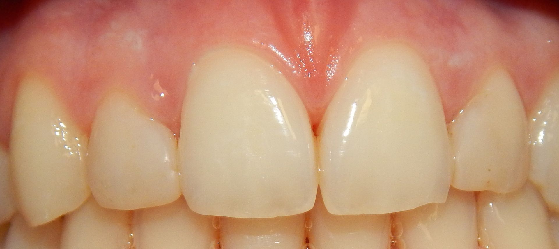 Primo piano della bocca e dei baffi di un uomo con uno spazio tra gli incisivi superiori