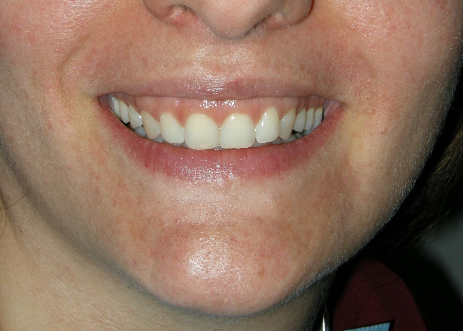 Primo piano di una bocca sorridente con denti bianchi e labbra lucide