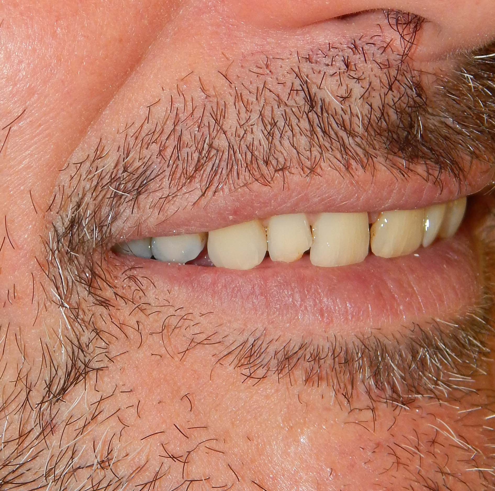Primo piano di una bocca sorridente con denti e barba incolta sul viso