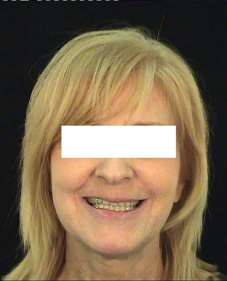 Persona bionda sorridente su uno sfondo scuro, con gli occhi coperti da una barra bianca