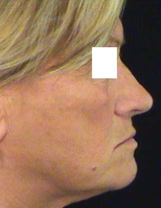 Profilo laterale di una persona con i capelli biondi corti su uno sfondo scuro.