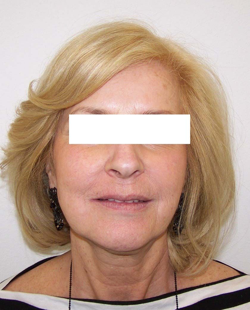 Ritratto di una persona bionda su uno sfondo neutro, con un top bianco e nero e degli orecchini.