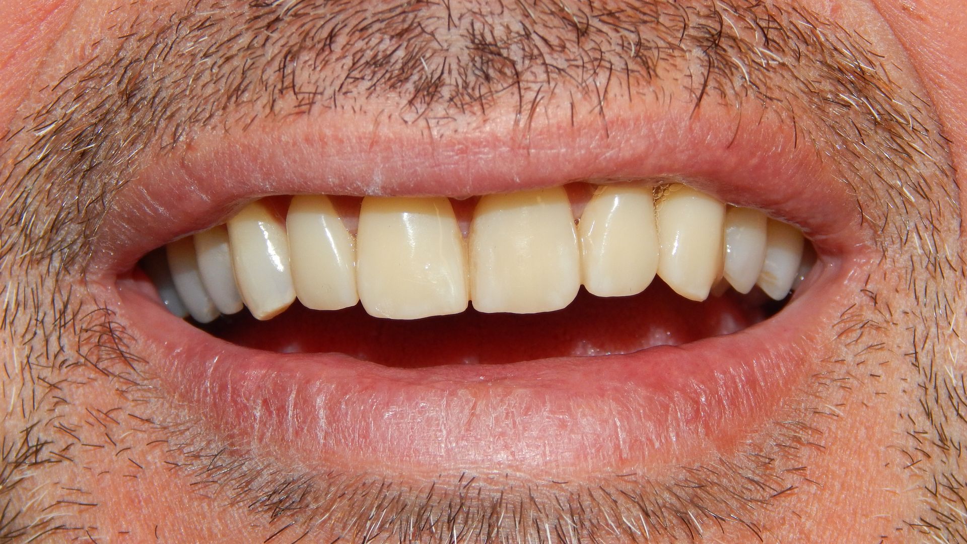Primo piano di una bocca sorridente con i denti visibili e una leggera barba incolta