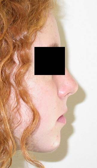 Profilo di una persona dai capelli rossi e ricci, con una barra nera sugli occhi, su uno sfondo chiaro