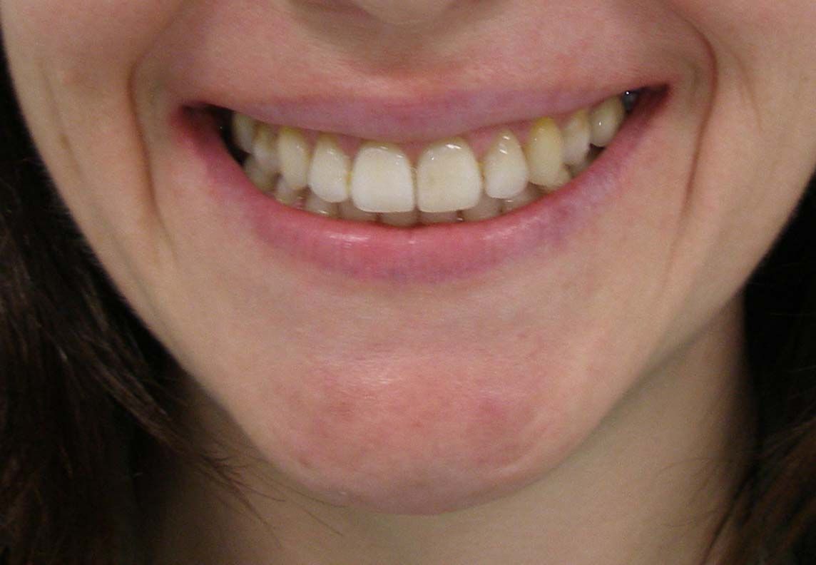 Primo piano di una bocca sorridente con denti e labbra visibili