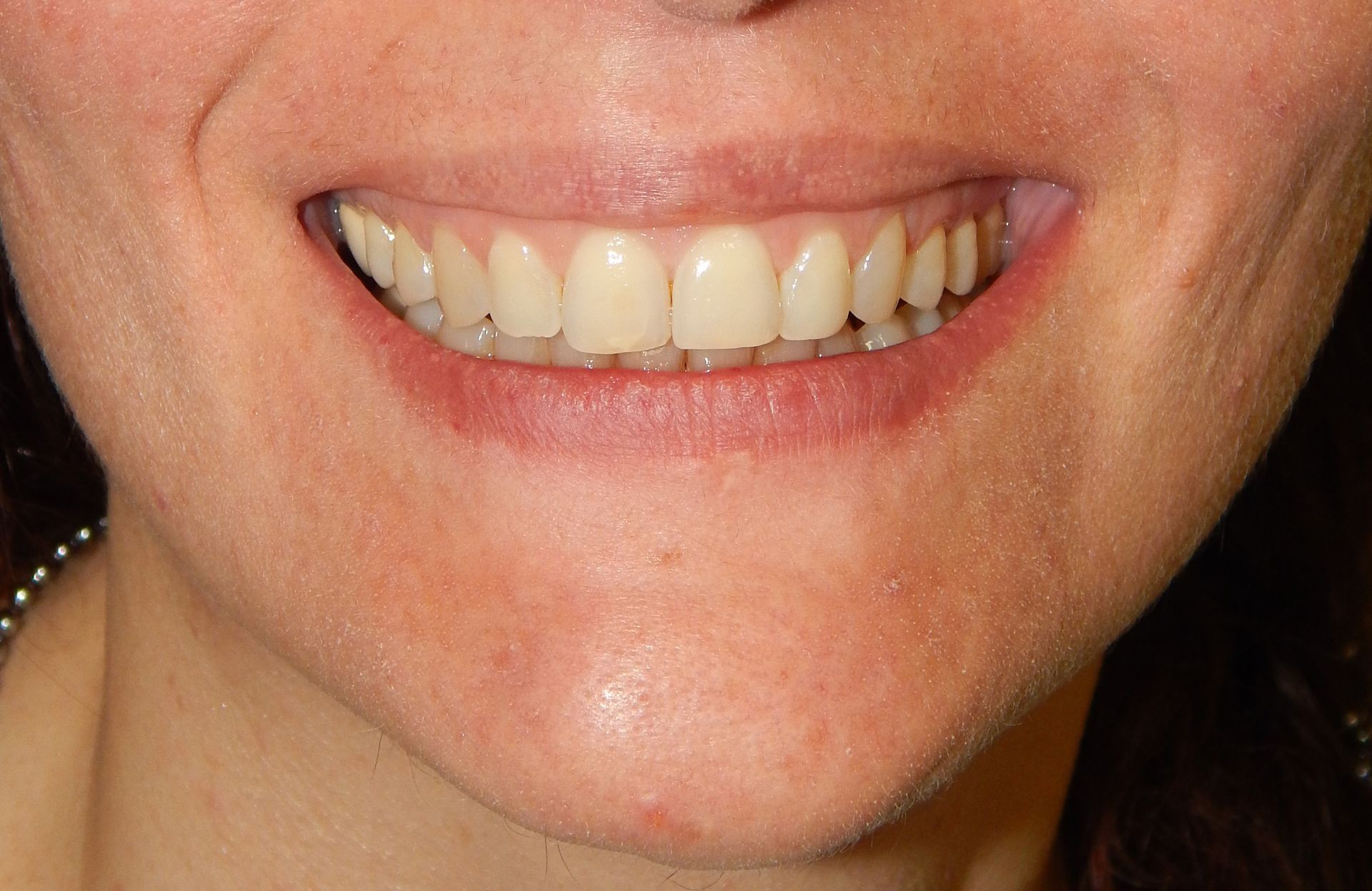 Primo piano di una bocca sorridente con denti e labbra rosa chiaro