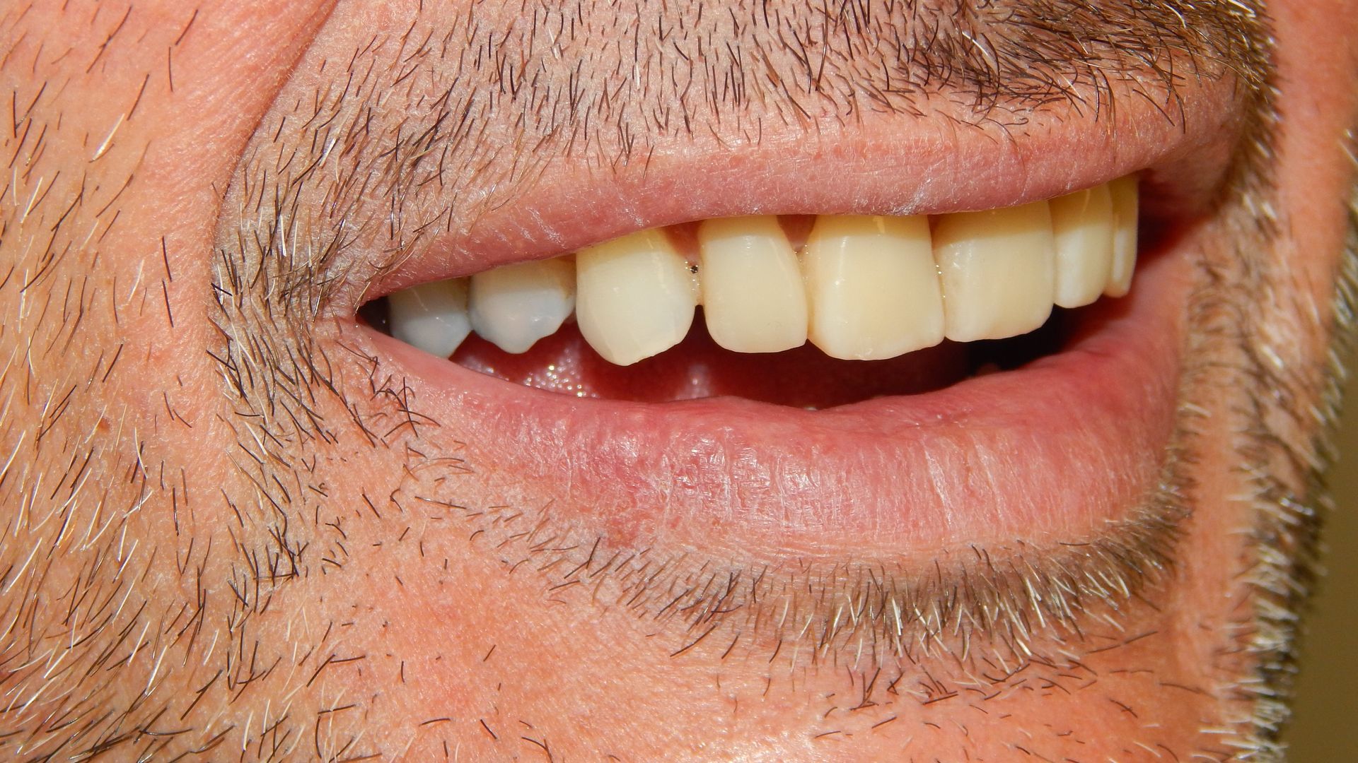 Primo piano di una bocca sorridente, con i denti e la barba ispida intorno alle labbra visibili